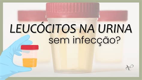 o que é leucocitos na urina - flanax para que serve